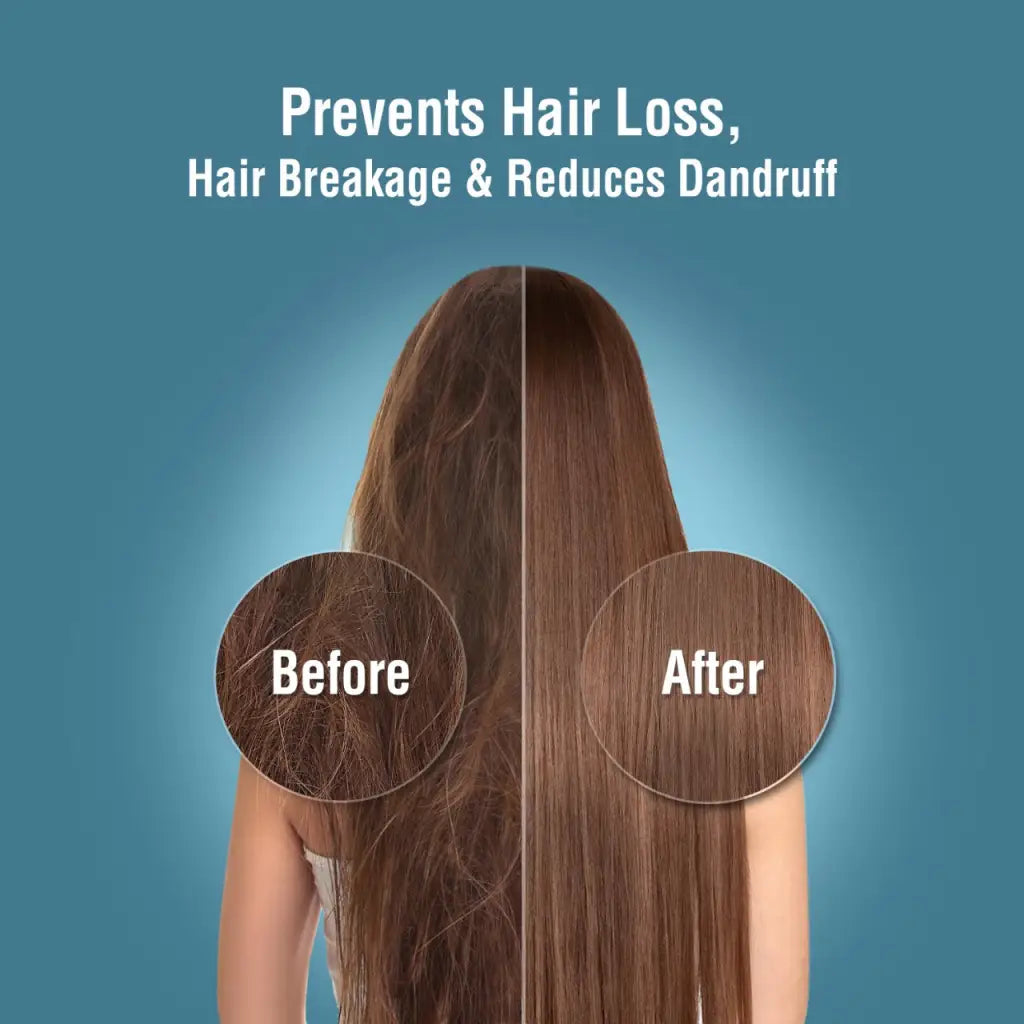 prevents hair loss